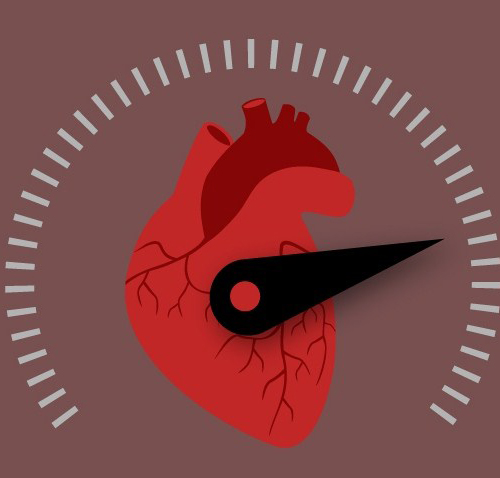 تاکی کاردی یا افزایش ضربان قلب تاکی کاردی یا افزایش ضربان قلب